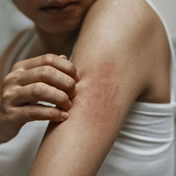 Sensitive Skin